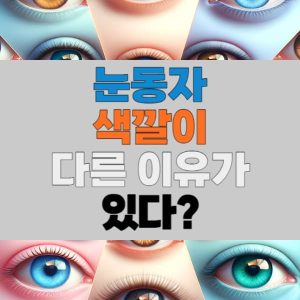 눈동자 색깔이 다른 이유가 있다?