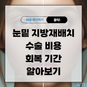 눈밑 지방재배치 수술 비용 회복 기간 알아보기