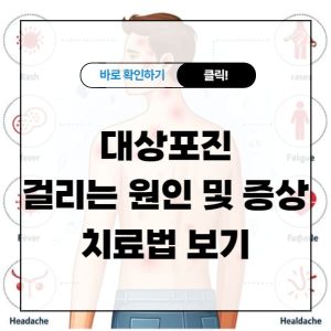 대상포진 걸리는 원인 및 증상 치료법 보기