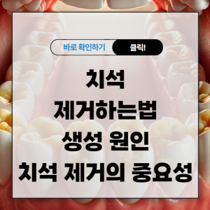 치석 제거하는법 생성 원인 치석 제거의 중요성